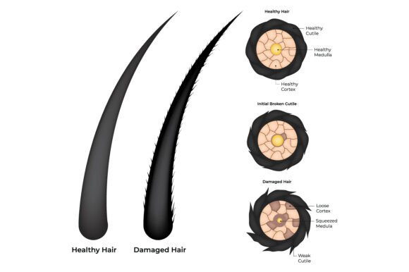 Download Healthy Vs Damaged Hair a Comparative - Comparative Collection